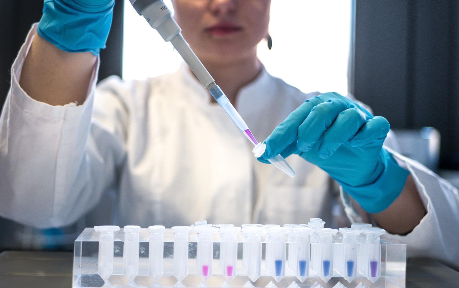 Modern Techniques In Research Peptide Synthesis